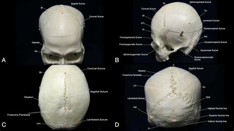 Cureus | Immersive Surgical Anatomy of the Craniometric Points