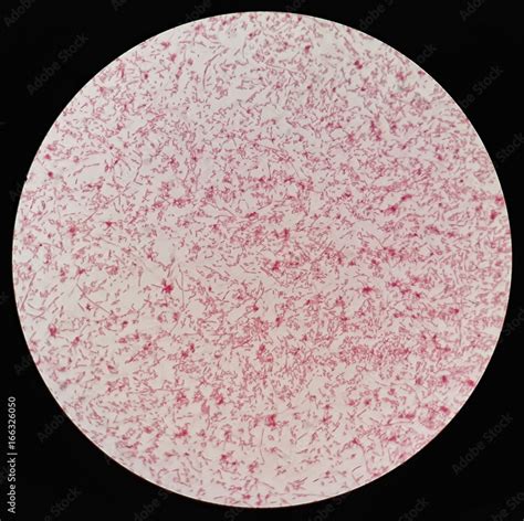 Smear of gram negative bacilli bacteria under 100X light microscope ...