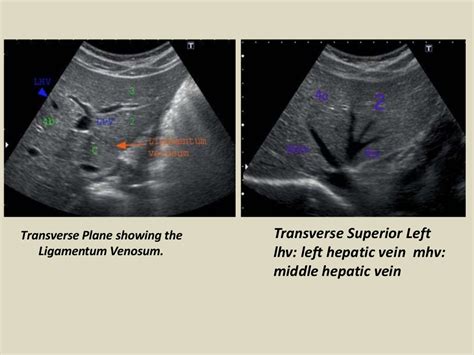 Presentation1, abdominal ultrasound anatomy.