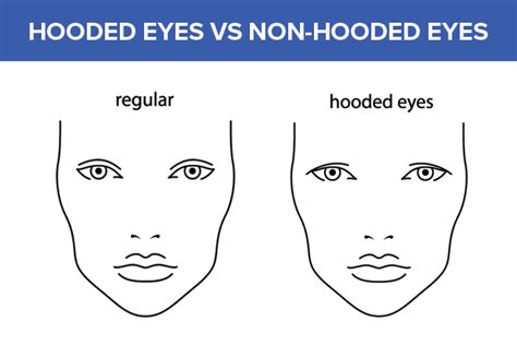 Hooded Eyes - All About Vision