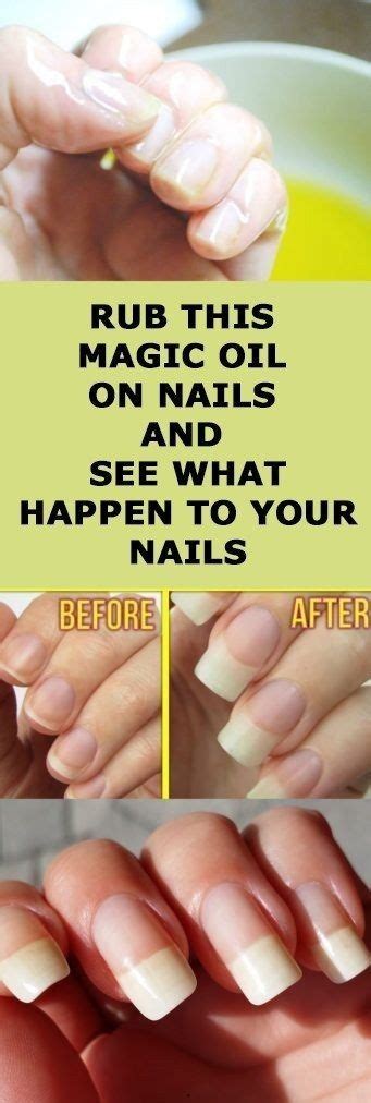 Best Home Remedies For Nails Growth And Hardening | Nail growth, Strong nails, Home remedies