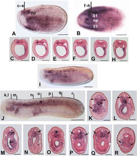 BfHMGA expression in the neurula. Anterior is to the left in all... | Download Scientific Diagram