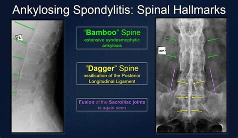 Pin by Raghav Tiwari on Radiology | Diagnostic imaging, Medical radiography, Radiology