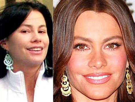 Sofia Vergara Before And After Pictures