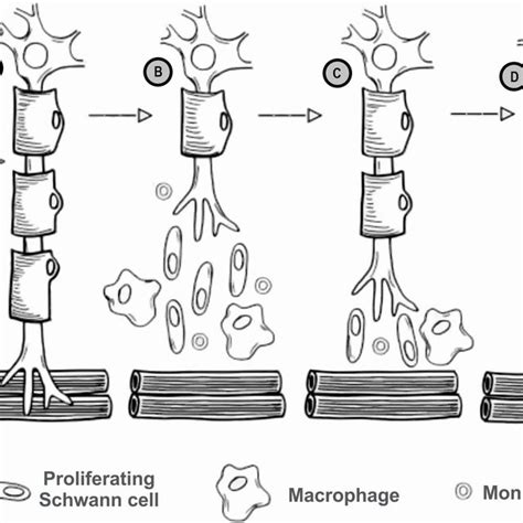 Process of Wallerian degeneration after peripheral nerve injury (A ...