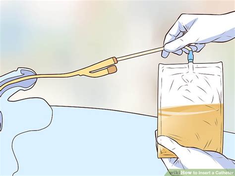 How to Insert a Catheter: 11 Steps (with Pictures) - wikiHow