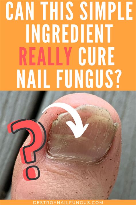 How You Can Use Baking Soda To Fight Toenail Fungus (Now!)