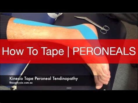 Peroneal Tendonitis Taping Technique