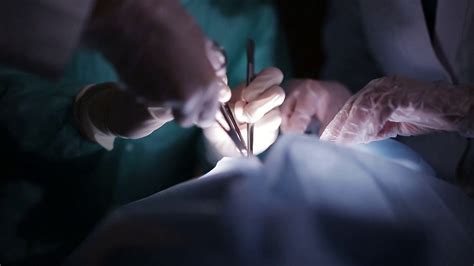 Doctors Surgeons Operate Patient In Stock Footage SBV-312722211 ...