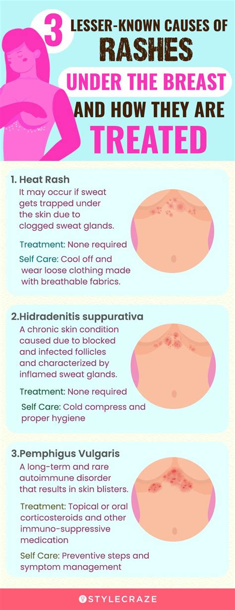 garbage Flawless Supplement red spots on skin under breasts Potential ...