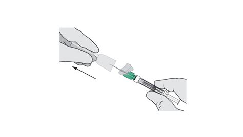 Administration & Dosing | Schizophrenia Injection | UZEDY™ (risperidone) extended-release ...