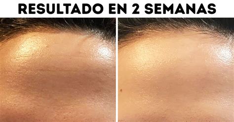 12 Personas que lograron conseguir que su cutis sea perfecto. Sus secretos pueden serte útiles ...