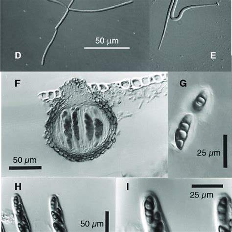 e Spores of the aquatic hyphomycetes, Flabellospora sp. (A), Alatospora ...