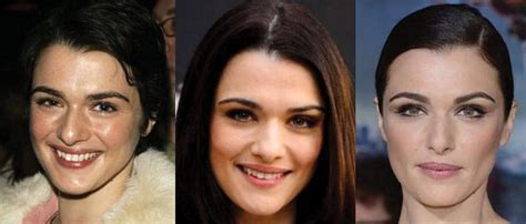 Rachel Weisz Plastic Surgery Before and After Pictures 2024