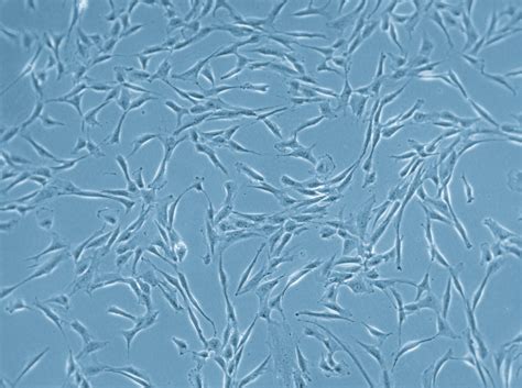 Mesenchymal Stem Cell Research: Some MSCs are More Equal than Others