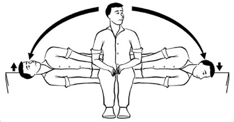 Semont Maneuver for treatment of right-sided posterior semicircular ...