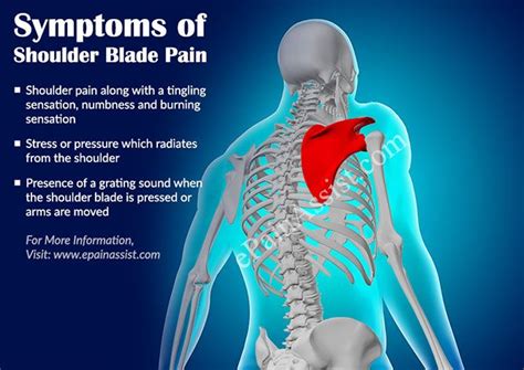 How Long Does It Take For A Shoulder Blade Injury To Heal - Robert Lopez Kapsels