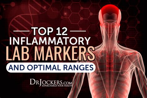 Top 12 Inflammatory Lab Markers and Optimal Ranges