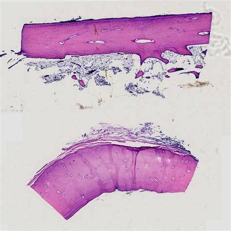 Decalcified Compact bone l.s. & c.s. show Osteon and Haversian System, H.E. Stain