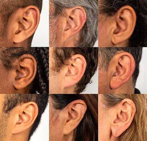 multiple images of the same person's ear