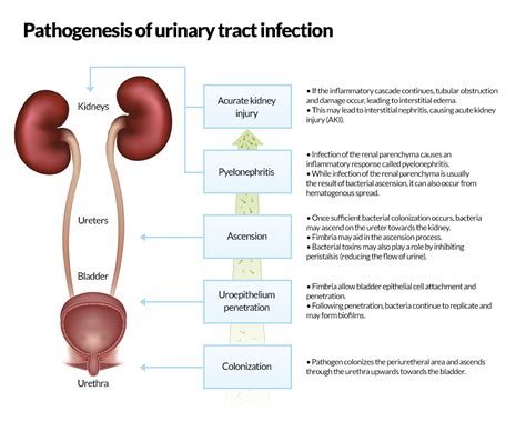 UTI Uncomplicated: Acute Simple Cystitis | Nursing CEU | CEUfast