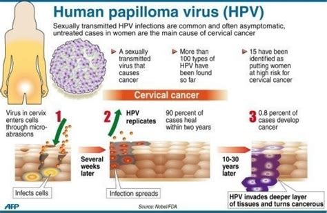 Cervical Cancer Hpv