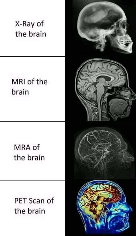 Brain Imaging Techniques : r/BrainMemes