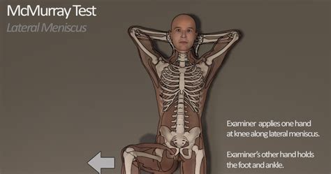 McMurray Test – Orthopedic Examination of the Knee