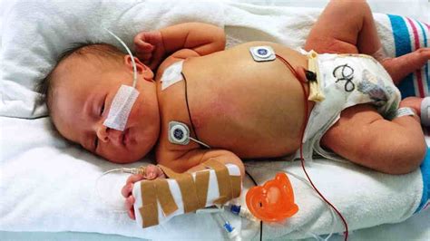 Shoulder Dystocia Can Spell Disaster for Babies | Birth Injury Lawyers