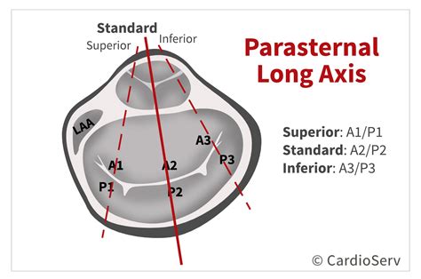 Finally... Mitral Valve Orientation Explained! Cardioserv