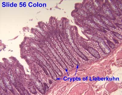 Colon Vs Small Intestine Histology / Intestinal Preparation Techniques ...