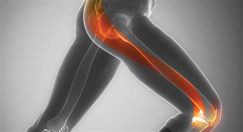 What Really Causes IT Band Syndrome Pain (And How Do You Fix It ...