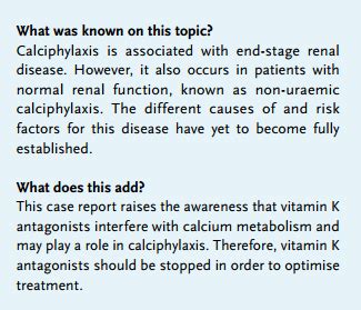 Article: Acenocoumarol as a risk factor for calciphylaxis: a feature ...