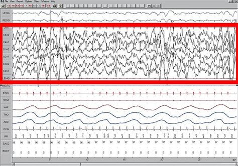 5 Strong Delta Waves Music Benefits & Side Effects [Don't Ignore Them]