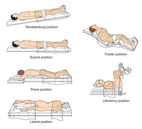 Surgical positions