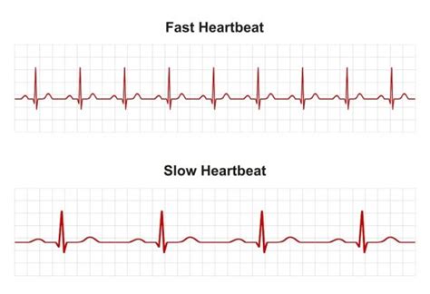 What Does An Abnormal ECG Mean? - Capital Heart Centre