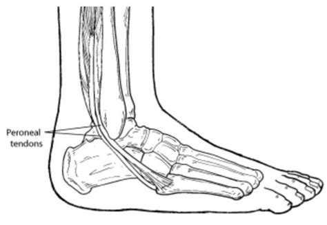 Peroneal Tendon Disorders - Dr Hamish Curry | Foot & Ankle Surgeon