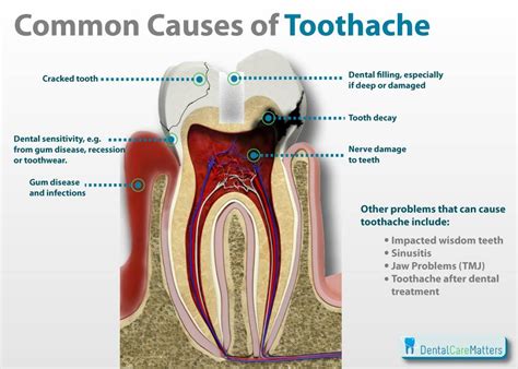 Pin on Dental Education