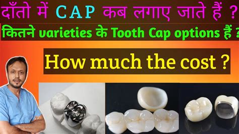 Types of Tooth Caps and cost | दाँतो की कैप एवं खर्च || Dental crowns ...