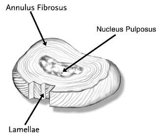 Intervertebral Disc - Spine - Orthobullets