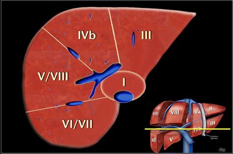 Anatomy of the liver segments | Liver anatomy, Medical radiography, Medical ultrasound