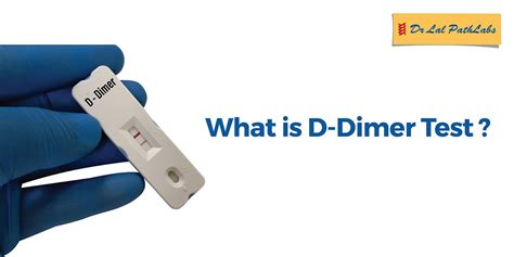 D-Dimer Test - What It Is, Who Needs It, and Its Risk Factors - Dr Lal PathLabs Blog