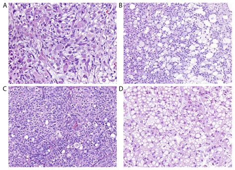 The dog as an animal model for bladder and urethral urothelial carcinoma: Comparative ...