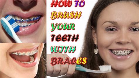 How to Brush your Teeth with Braces? | Easy way to Brush your Teeth ...