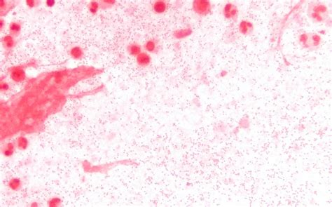 Haemophilus Influenzae Type B Gram Stain