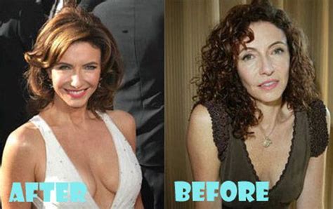 Mary Steenburgen Plastic Surgery Before and After | Celebrity plastic ...