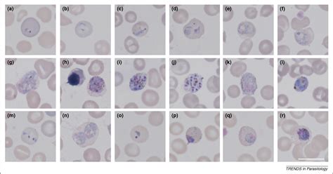 Figure 1 from Plasmodium vivax under the microscope: the Aotus model. | Semantic Scholar