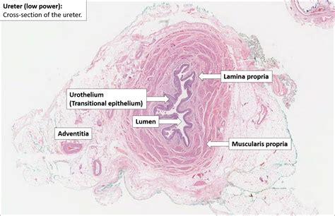 Ureter – Normal Histology – NUS Pathweb :: NUS Pathweb