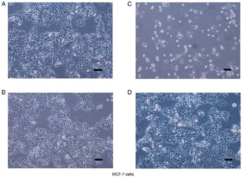 Cell morphology after transfection. Stable SBEM knockdown or ...