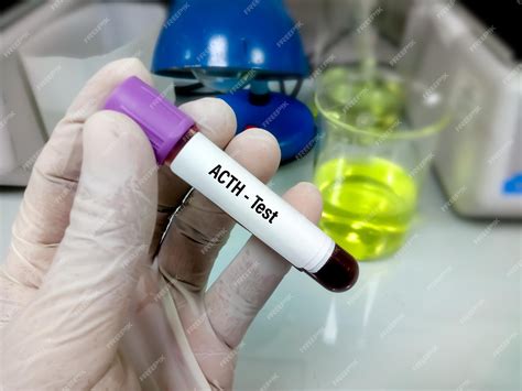 Premium Photo | Blood sample for Adrenocorticotropic hormone or ACTH test